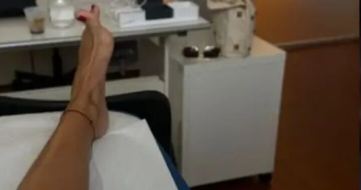 Giulia De Lellis neuroma di morton