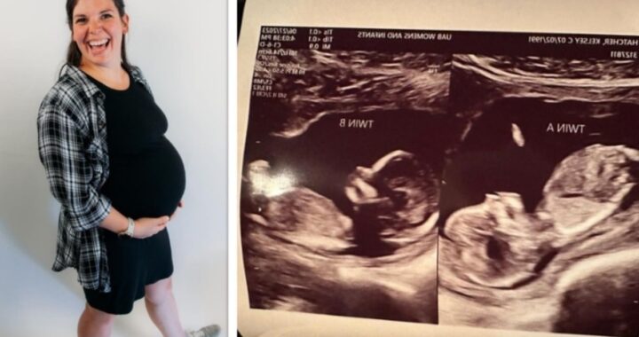 Kelsey Hatcher la mamma con due uteri