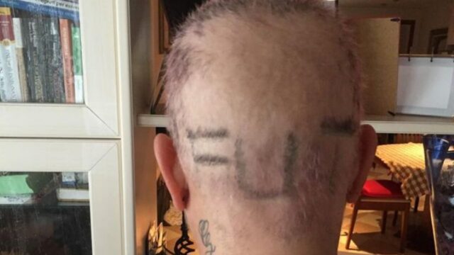 Carolyn Smith torna a parlare della sua battaglia e mostra le toccanti foto
