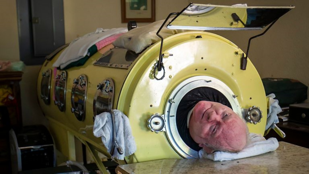 è morto Paul Alexander 