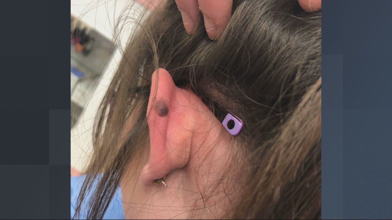 girl ear dot