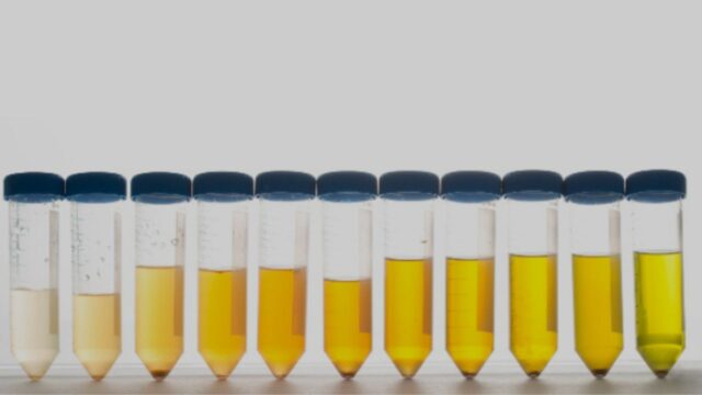 Il colore delle nostre urine ci dice molto sulla nostra salute: quando dobbiamo preoccuparci