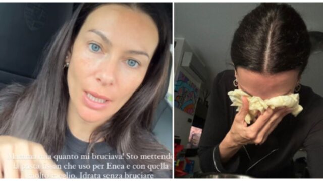 “La parte esterna sembra bruciata” tanta paura per la famosissima modella, ha un problema agli occhi