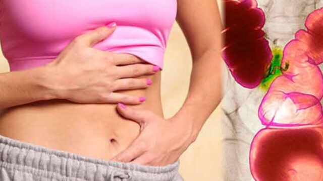 Soffri di colon irritabile? Questo rimedio allevierà i sintomi