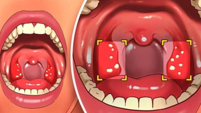 Puoi avere dei denti perfetti, ma devi seguire queste semplici abitudini: sono nove, ma la numero 5 è fondamentale