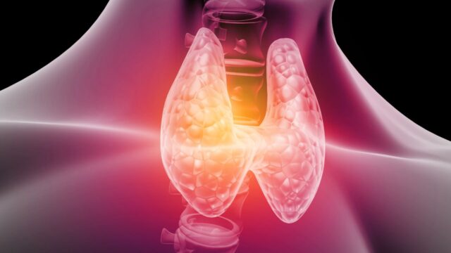 Tumore alla Tiroide, in aumento i casi tra i giovani: come riconoscerlo
