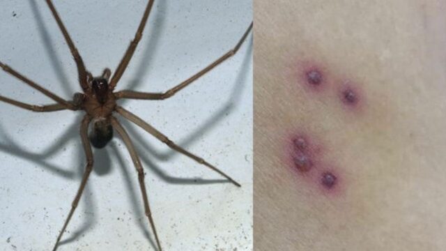 Allarme ragno violino, come riconoscerlo e dove si trova: ecco cosa devi fare
