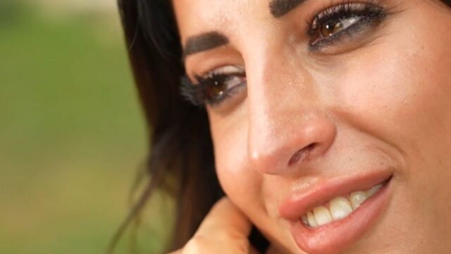 “Sono stata brava a nasconderlo” la famosissima si mostra con una vistosa benda sul naso e spiega cos’è successo