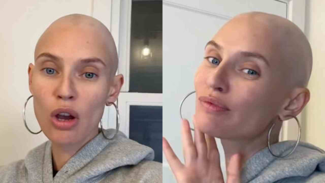Bianca Balti, il suo tumore  è legato ad una mutazione in particolare: quali sono i sintomi e trattamenti del cancro