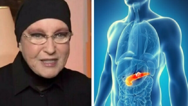 Cos’è il tumore al pancreas, la malattia che ha colpito Eleonora Giorgi: sintomi e cure 