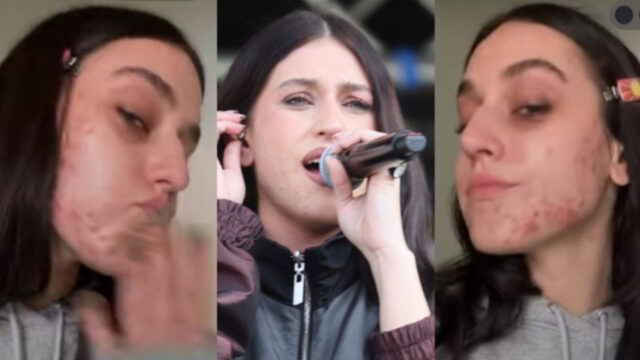 “Dopo Sanremo ho trascurato il mio corpo” la famosissima cantante si mostra con questi segni sui social: lo sfogo