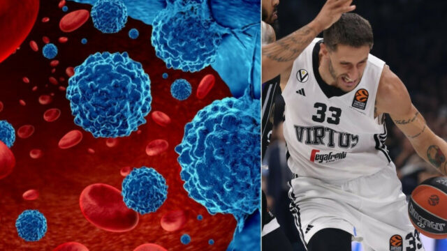 Cos’è la leucemia mieloide, la malattia che ha colpito Achille Polonara e ha strappato la vita a Sinisa Mihajlovic: diagnosi, sintomi e cure