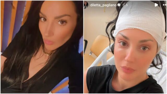 “Un intervento di oltre dieci ore” Il volto di Uomini e Donne in ospedale: cosa è successo e come sta ora