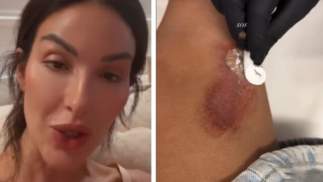 “Era in motorino” Paura per l’ex tronista, ferita in modo brusco durante un incidente. Cos’è successo