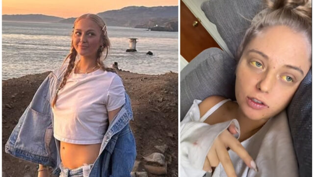 “Sembrava una semplice macchia gialla sul corpo mi dicevano che non era grave, ma dopo due trapianti sono in pericolo di vita”