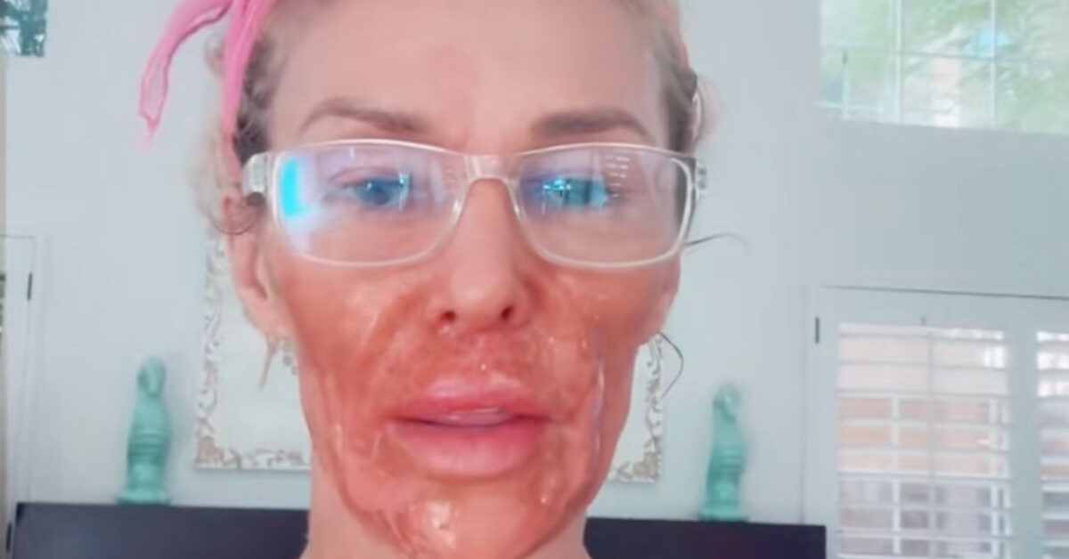 Brandi Glanville: L'Orrore della Crema Depilatoria Nair! Cosa è Successo e Come Evitare il Disastro