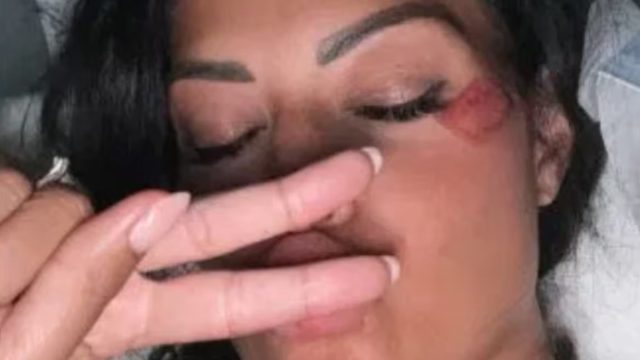“Ad un certo punto ero a terra” Incidente per il volto di Canale 5: paura per le sue condizioni